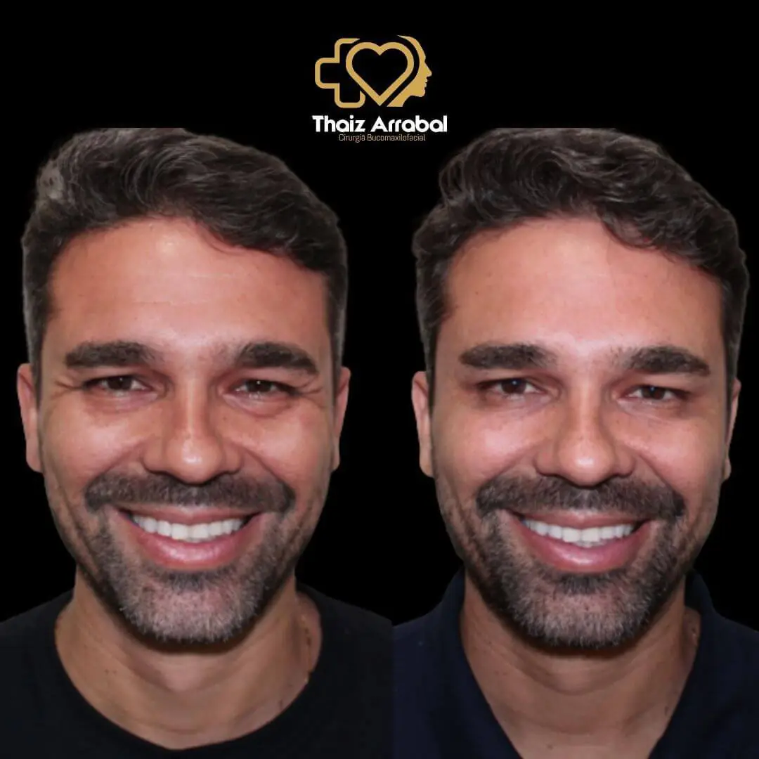 Antes e depois — registro clínico 27 do Instituto da Face